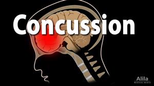 Concussion video